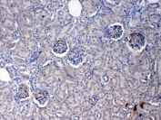 IHC testing of FFPE mouse kidney tissue with Crp antibody at 1ug/ml. Required HIER: steam section in pH6 citrate buffer for 20 min and allow to cool prior to testing.