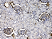 IHC testing of FFPE rat kidney tissue with Crp antibody at 1ug/ml. Required HIER: steam section in pH6 citrate buffer for 20 min and allow to cool prior to testing.