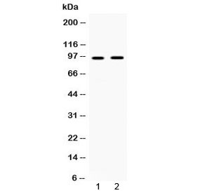 Western blot testing of human 1) HepG2 and 2) SKOV3 cell lysate with IFNGR1 antibody at 0.5ug/ml. Predicted molecular weight: ~54 kDa (unmodified), 80-100 kDa (glycosylated).~