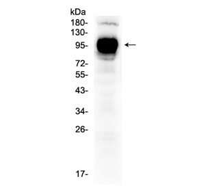Western blot testing of human HepG2 cell lysate with CD119 antibody at 0.5ug/ml. Predicted molecular weight: ~54 kDa (unmodified), 80-100 kDa (glycosylated).~