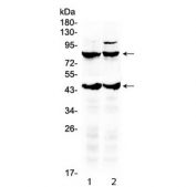 Western blot testing of 1) rat brain and 2) mouse brain lysate with TSH Receptor antibody. Predicted molecular weight ~87 kDa (full length), ~44 kDa (beta subunit).