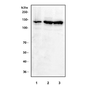 Western blot testing of 1) human HeLa and 2) mouse NIH3T3 cell lysate with IFNAR1 antibody at 0.5ug/ml. Predicted molecular weight ~64 kDa.~
