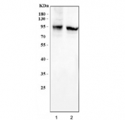 Western blot testing of human 1) SiHa and 2) HeLa cell lysate with Endoglin antibody. Observed molecular weight: 70/90 kDa (monomer, unmodified/glycosylated); 140-180 kDa (dimer, unmodified/glycosylated).