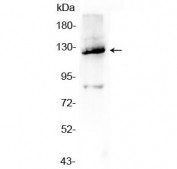 Western blot testing of human A549 cell lysate with Vinculin antibody at 0.5ug/ml. Predicted molecular weight ~124 kDa.