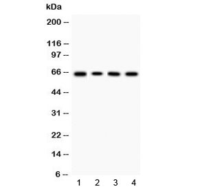Western blot testing of 1) rat thymus, 2) mouse thymus, 3) human HeLa and 4) human K562 lysate with LBP antibody at 0.5ug/ml. Predicted molecular weight ~65 kDa.