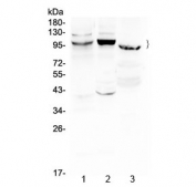 Western blot testing of 1) rat liver, 2) mouse liver and 3) human MCF7 cell lysate with ATF6 antibody at 0.5ug/ml. Predicted molecular weight ~75 kDa, rountinely observed at 90-100 kDa.