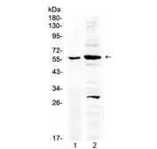 Western blot testing of 1) rat stomach and 2) mouse brain lysate with TNFR1 antibody at 0.5ug/ml. Predicted molecular weight ~51 kDa, observed here at ~60 kDa.