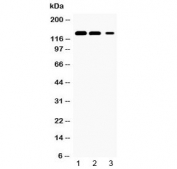 Western blot testing of 1) rat kidney, 2) mouse kidney and 3) human HeLa lysate with JAK1 antibody at 0.5ug/ml.  Predicted molecular weight ~133 kDa.