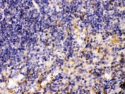 IHC testing of FFPE mouse spleen tissue with MMP11 antibody at 1ug/ml. Required HIER: steam section in pH6 citrate buffer for 20 min and allow to cool prior to testing.