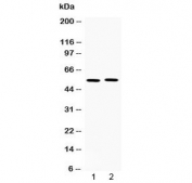 Western blot testing of 1) rat spleen and 2) human MM231 lysate with MMP11 antibody at 0.5ug/ml. Predicted molecular weight ~55 kDa.