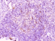IHC testing of FFPE rat spleen tissue with MMP11 antibody at 1ug/ml. Required HIER: steam section in pH6 citrate buffer for 20 min and allow to cool prior to testing.