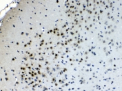 IHC testing of FFPE rat brain tissue with Choline acetyltransferase antibody at 1ug/ml. Required HIER: steam section in pH6 citrate buffer for 20 min and allow to cool prior to testing.