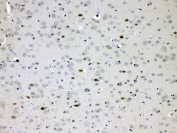 IHC testing of FFPE mouse brain tissue with Choline acetyltransferase antibody at 1ug/ml. Required HIER: steam section in pH6 citrate buffer for 20 min and allow to cool prior to testing.