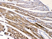 IHC testing of FFPE mouse heart tissue with CHRNA5 antibody at 1ug/ml. Required HIER: steam section in pH6 citrate buffer for 20 min and allow to cool prior to testing.