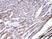 IHC testing of FFPE rat heart tissue with CHRNA5 antibody at 1ug/ml. Required HIER: steam section in pH6 citrate buffer for 20 min and allow to cool prior to testing.