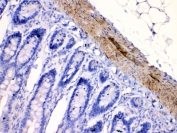 IHC testing of FFPE rat intestine tissue with CHRNA5 antibody at 1ug/ml. Required HIER: steam section in pH6 citrate buffer for 20 min and allow to cool prior to testing.