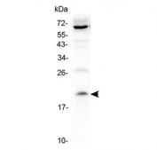 Western blot testing of human 1) HepG2 and 2) K562 cell lysate with IL-13 antibody at 0.5ug/ml. Predicted molecular weight: 13-16 kDa.