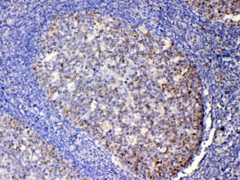 IHC testing of FFPE human tonsil tissue with IL-13 antibody at 1ug/ml. Required HIER: steam section in pH6 citrate buffer for 20 min and allow to cool prior to testing.~