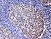 IHC testing of FFPE human tonsil tissue with IL-13 antibody at 1ug/ml. Required HIER: steam section in pH6 citrate buffer for 20 min and allow to cool prior to testing.