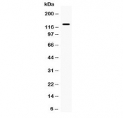 Western blot testing of human HeLa cell lysate with iNOS antibody at 0.5ug/ml. Predicted molecular weight ~130 kDa.