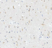 Western blot testing of human HeLa cell lysate with iNOS antibody at 0.5ug/ml. Predicted molecular weight ~130 kDa.