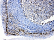 IHC testing of FFPE human tonsil tissue with CD147 antibody at 1ug/ml. Required HIER: steam section in pH6 citrate buffer for 20 min and allow to cool prior to testing.