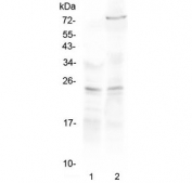 Western blot testing of 1) rat kidney and 2) mouse NIH3T3 lysate with TIMP3 antibody at 0.5ug/ml. Predicted molecular weight ~24 kDa (unmodified) and ~33 kDa (glycosylated).