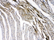 IHC testing of FFPE mouse heart tissue with GJC1 antibody at 1ug/ml. Required HIER: steam section in pH6 citrate buffer for 20 min and allow to cool prior to testing.