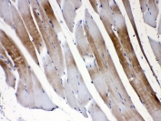 IHC testing of FFPE rat skeletal muscle tissue with GJC1 antibody at 1ug/ml. Required HIER: steam section in pH6 citrate buffer for 20 min and allow to cool prior to testing.