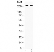 Western blot testing of human 1) HeLa and 2) SKOV3 cell lysate with BRCA1 antibody at 0.5ug/ml. Predicted molecular weight ~207 kDa, commonly observed at 207-220 kDa.