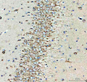 Immunohistochemistry analysis of MC3R expression in rat hippocampus tissue. Paraffin-embedded rat hippocampus sections were subjected to heat-mediated antigen retrieval in EDTA buffer (pH 8.0) and incubated with anti-MC3R antibody, followed by HRP-conjugated secondary antibody and DAB chromogen development. Brown staining is observed in hippocampal neurons, consistent with melanocortin 3 receptor localization in brain regions involved in neuroendocrine regulation, with hematoxylin nuclear counterstain (blue).