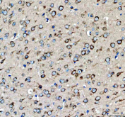 Immunohistochemistry analysis of MC3R expression in mouse brain tissue. Paraffin-embedded mouse brain sections were subjected to heat-mediated antigen retrieval in EDTA buffer (pH 8.0) and incubated with anti-MC3R antibody, followed by HRP-conjugated secondary antibody and DAB chromogen development. MC3R staining is detected in neuronal cells and surrounding neuropil, consistent with central nervous system expression of melanocortin 3 receptor, with hematoxylin nuclear counterstain (blue).