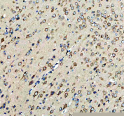 Immunohistochemistry analysis of MC3R expression in rat brain tissue. Paraffin-embedded rat brain sections were subjected to heat-mediated antigen retrieval in EDTA buffer (pH 8.0) and incubated with anti-MC3R antibody, followed by HRP-conjugated secondary antibody and DAB chromogen development. MC3R immunoreactivity is observed in neuronal cells across brain regions, consistent with central nervous system expression of melanocortin 3 receptor, with hematoxylin nuclear counterstain (blue).