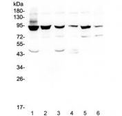 Western blot testing of human 1) HeLa, 2) PC-3, 3) Caco-2, 4) A549, 5) K562 and 6) Raji cell lysate with STAT1 antibody at 0.5ug/ml. Predicted molecular weight ~91/84 kDa (alpha/beta).