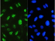 IF/ICC staining of FFPE human U-2 OS cells with STAT1 antibody (green) at 2ug/ml and DAPI nuclear stain (blue). HIER: steam section in pH6 citrate buffer for 20 min and allow to cool prior to testing.
