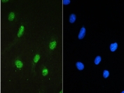 IF/ICC staining of FFPE human U-2 OS cells with STAT1 antibody (green) at 2ug/ml and DAPI nuclear stain (blue). HIER: steam section in pH6 citrate buffer for 20 min and allow to cool prior to testing.