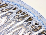 IHC testing of FFPE rat intestine tissue with RanBP1 antibody at 1ug/ml. Required HIER: steam section in pH6 citrate buffer for 20 min and allow to cool prior to testing.