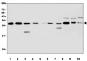Western blot testing of 1) human K562, 2) human HEK293, 3) human HL60, 4) human U-2 OS, 5) human A431, 6) human HepG2, 7) human U937, 8) rat testis, 9) rat C6 and 10) mouse testis tissue lysate with RanBP1 antibody. Expected molecular weight 23-26 kDa.