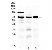 Western blot testing of 1) rat testis, 2) mouse testis and 3) human placenta lysate with 5HT3A Receptor antibody at 0.5ug/ml. Predicted molecular weight ~55 kDa, observed here at ~72 kDa.