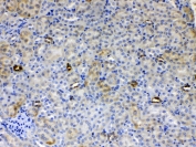 IHC testing of FFPE mouse kidney tissue with ALDH1A3 antibody at 1ug/ml. Required HIER: steam section in pH6 citrate buffer for 20 min and allow to cool prior to testing.