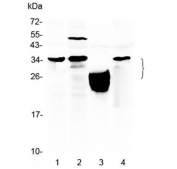 Western blot testing of 1) mouse spleen, 2) human HeLa, 3) human placenta and 4) human MCF7 lysate with TFPI2 antibody at 0.5ug/ml. Expected molecular weight: ~27 kDa (unmodified), 30-35 kDa (glycosylated).