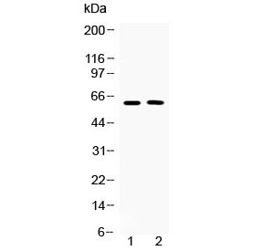 Western blot testing of human 1) COLO320 and 2) MCF7 cell lysate with Tubby antibody at 0.5ug/ml. Predicted molecular weight ~56/62 kDa (isoforms 1/2).~