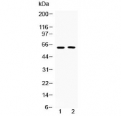 Western blot testing of human 1) COLO320 and 2) MCF7 cell lysate with Tubby antibody at 0.5ug/ml. Predicted molecular weight ~56/62 kDa (isoforms 1/2).