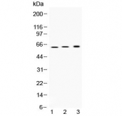 Western blot testing of 1) rat stomach, 2) mouse stomach and 3) human SGC-7901 (human gastric cancer) lysate with ATP4B antibody at 0.5ug/ml. Predicted molecular weight ~34 kDa (core peptide), ~52 kDa (beta subunit precursor), 60-80 kDa (glycosylated form).