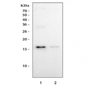 IHC testing of FFPE human appendicitis tissue with IBA1 antibody at 1ug/ml. Required HIER: steam section in pH6 citrate buffer for 20 min and allow to cool prior to testing.