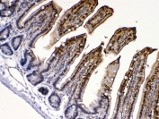 IHC testing of FFPE mouse intestine tissue with FABP2 antibody at 1ug/ml. Required HIER: steam section in pH6 citrate buffer for 20 min and allow to cool prior to testing.