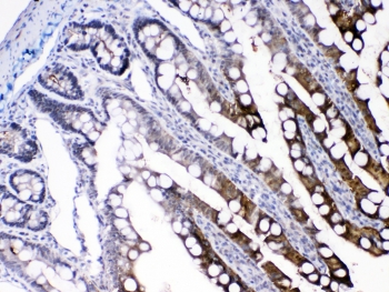 IHC testing of FFPE rat intestine tissue with FABP2 antibody at 1ug/ml. Required HIER: steam section in pH6 citrate buffer for 20 min and allow to cool prior to testing.