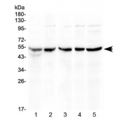 Western blot testing of 1) rat thymus, 2) mouse thymus, 3) mouse spleen, 4) human COLO320 and 5) human HeLa lysate with EIF3e antibody at 0.5ug/ml. Expected molecular weight: 48-52 kDa.