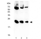 Western blot testing of human 1) HeLa, 2) K562 and 3) Raji cell lysate with Interleukin-2 antibody at 0.5ug/ml. Predicted molecular weight: 14-18 kDa.