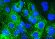 Immunofluorescent staining of FFPE human A431 cells with Beta-2 Microglobulin antibody (green) at 2ug/ml and DAPI nuclear stain (blue). HIER: steam section in pH6 citrate buffer for 20 min.